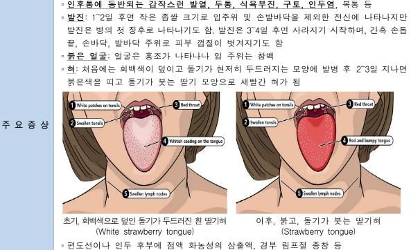오산시, 성홍열 환자 증가에 따른 시민 주의 당부